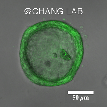 organoid in gel